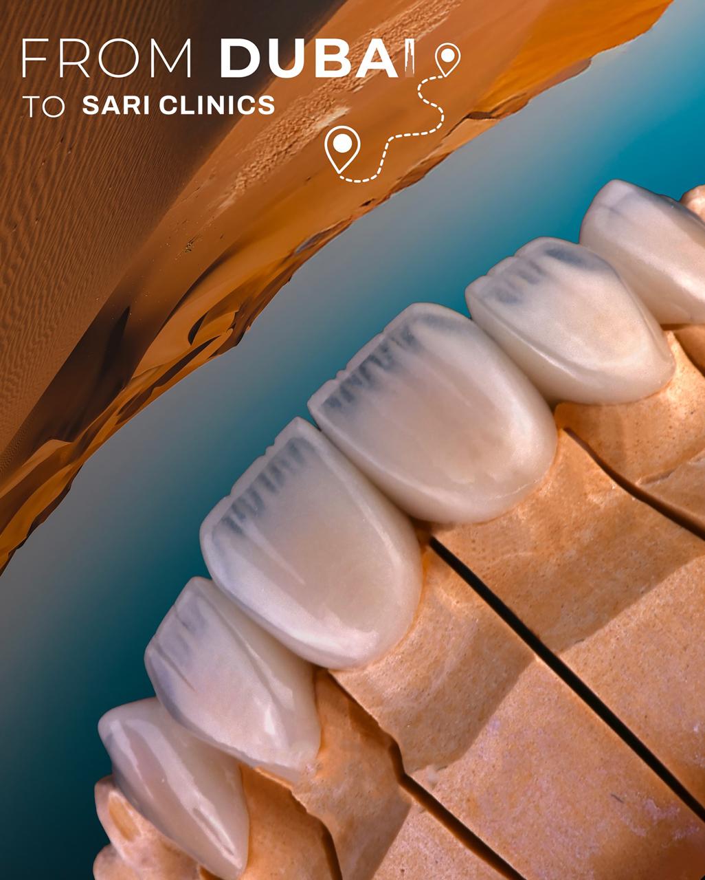From Dubai to Sari Clinics veneer case