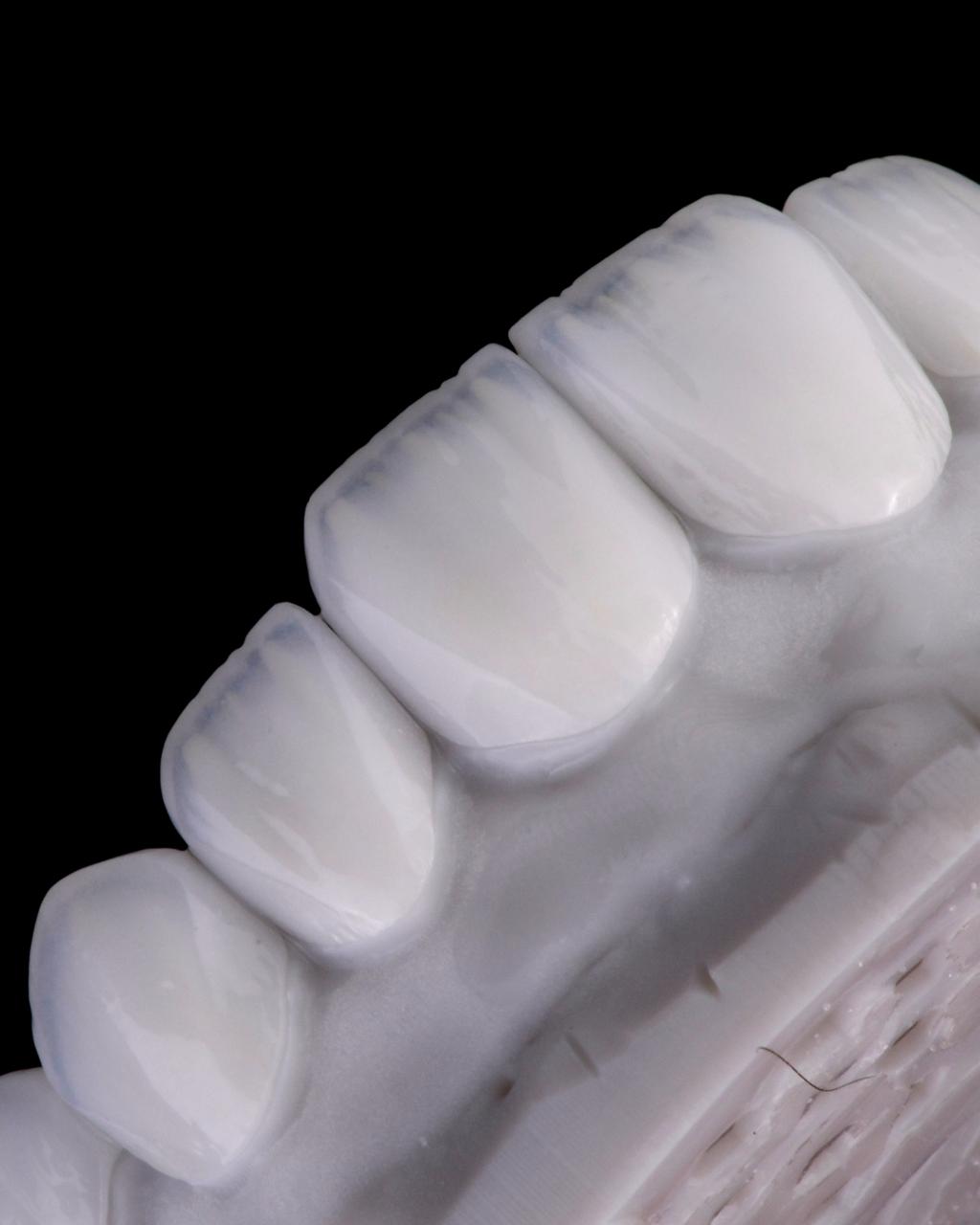 Ceramic layering study at Sari's Clinic