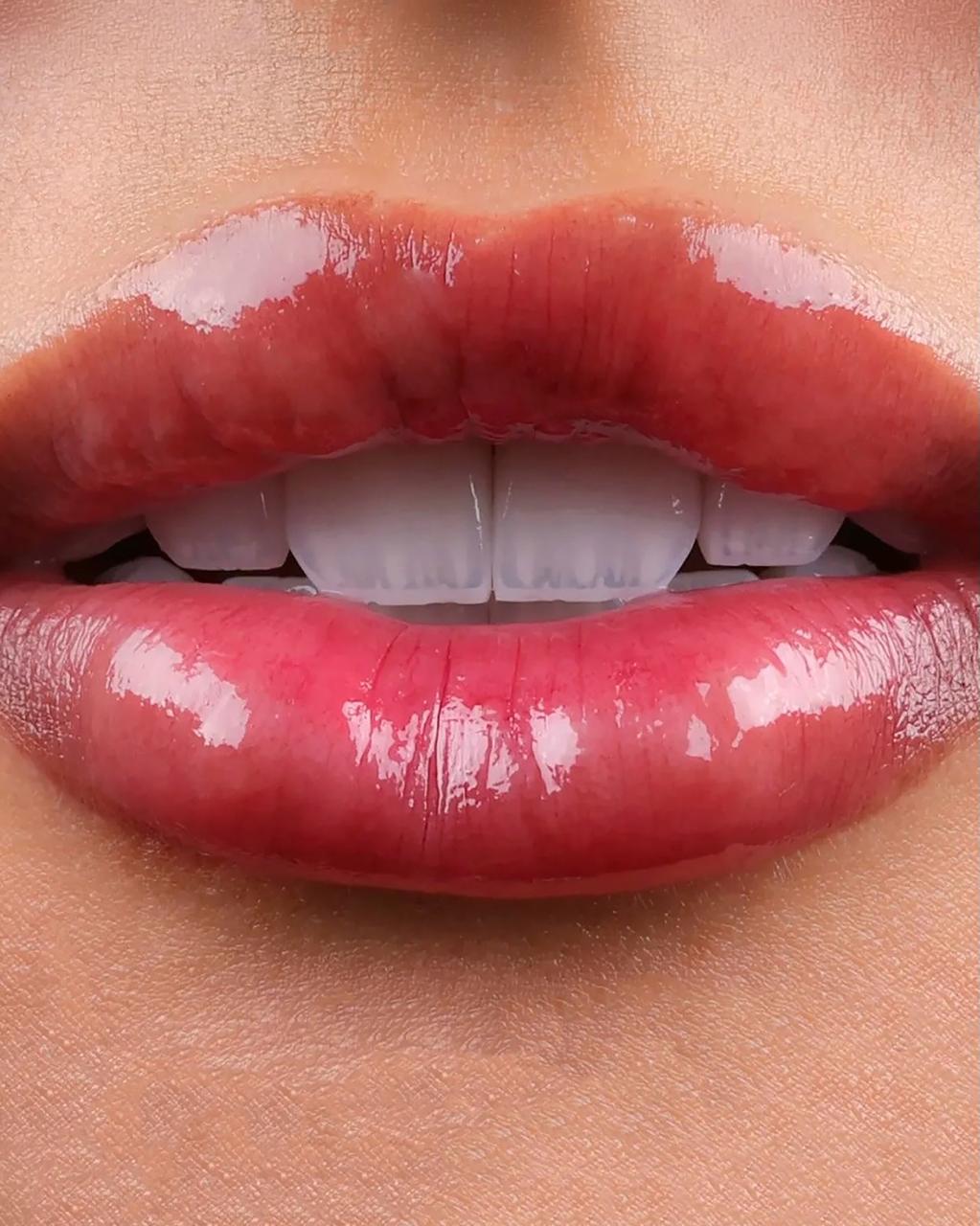 Polished smile finish at Sari's Clinic
