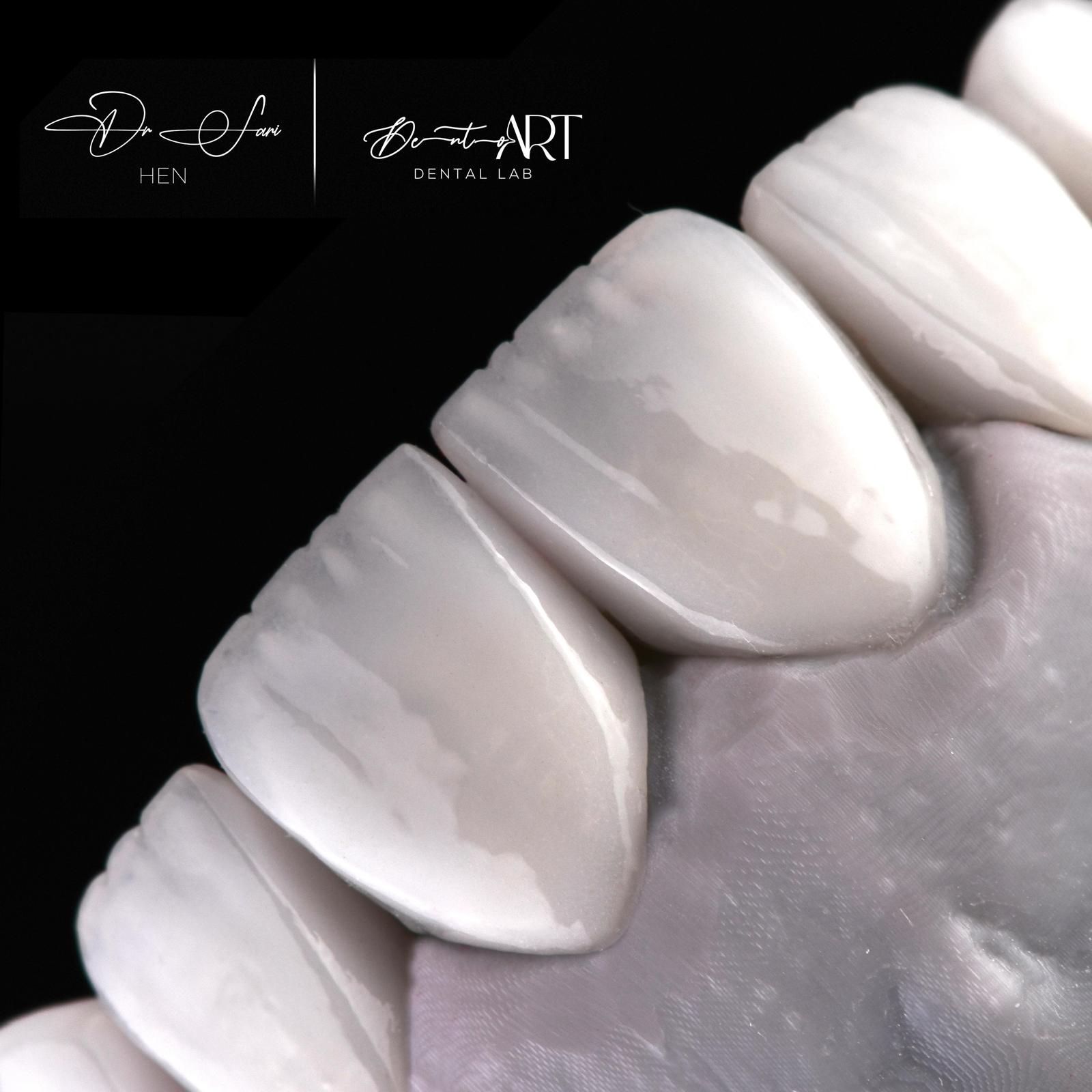 Master ceramist detail at Sari's Clinic