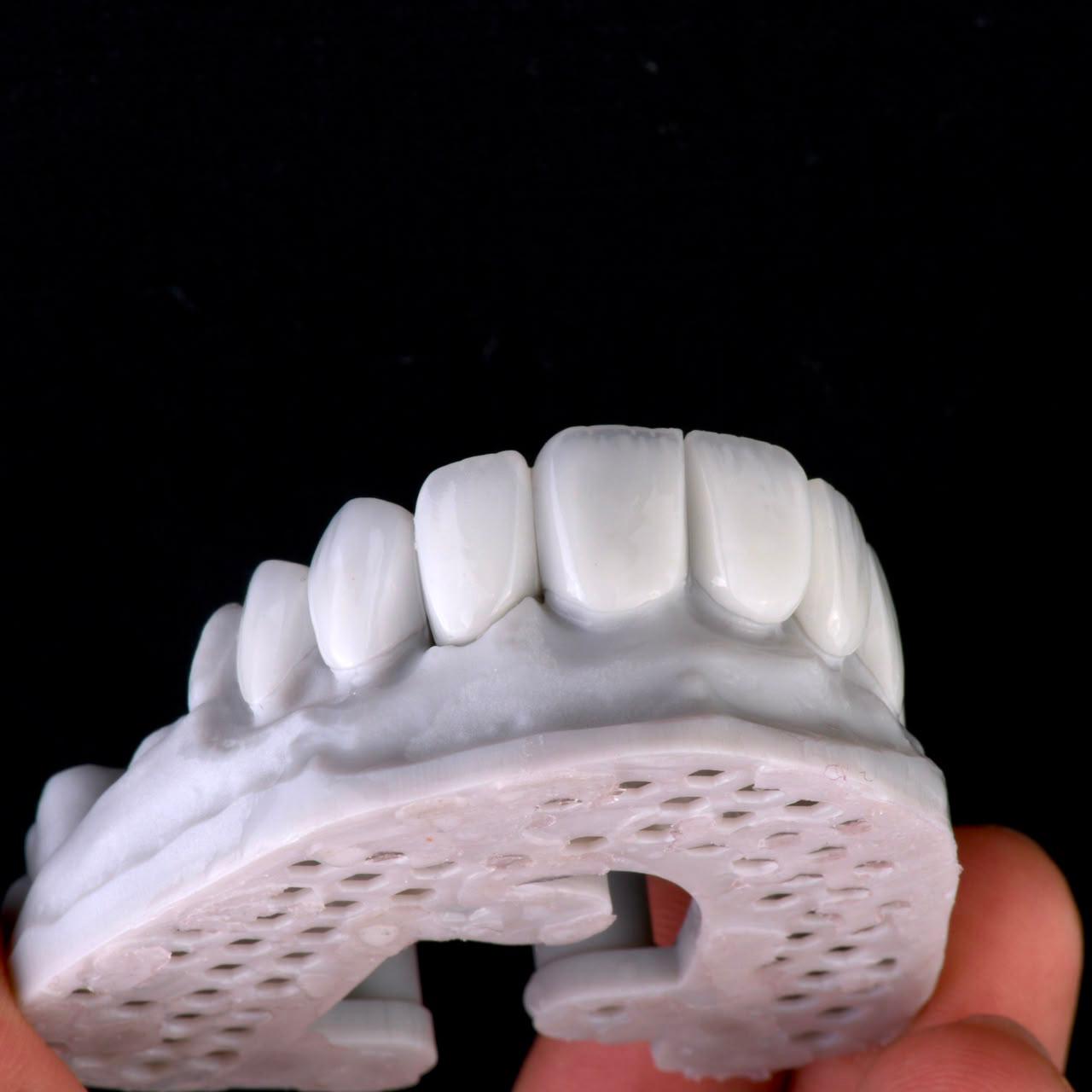 Dental ceramic case at Sari's Clinic