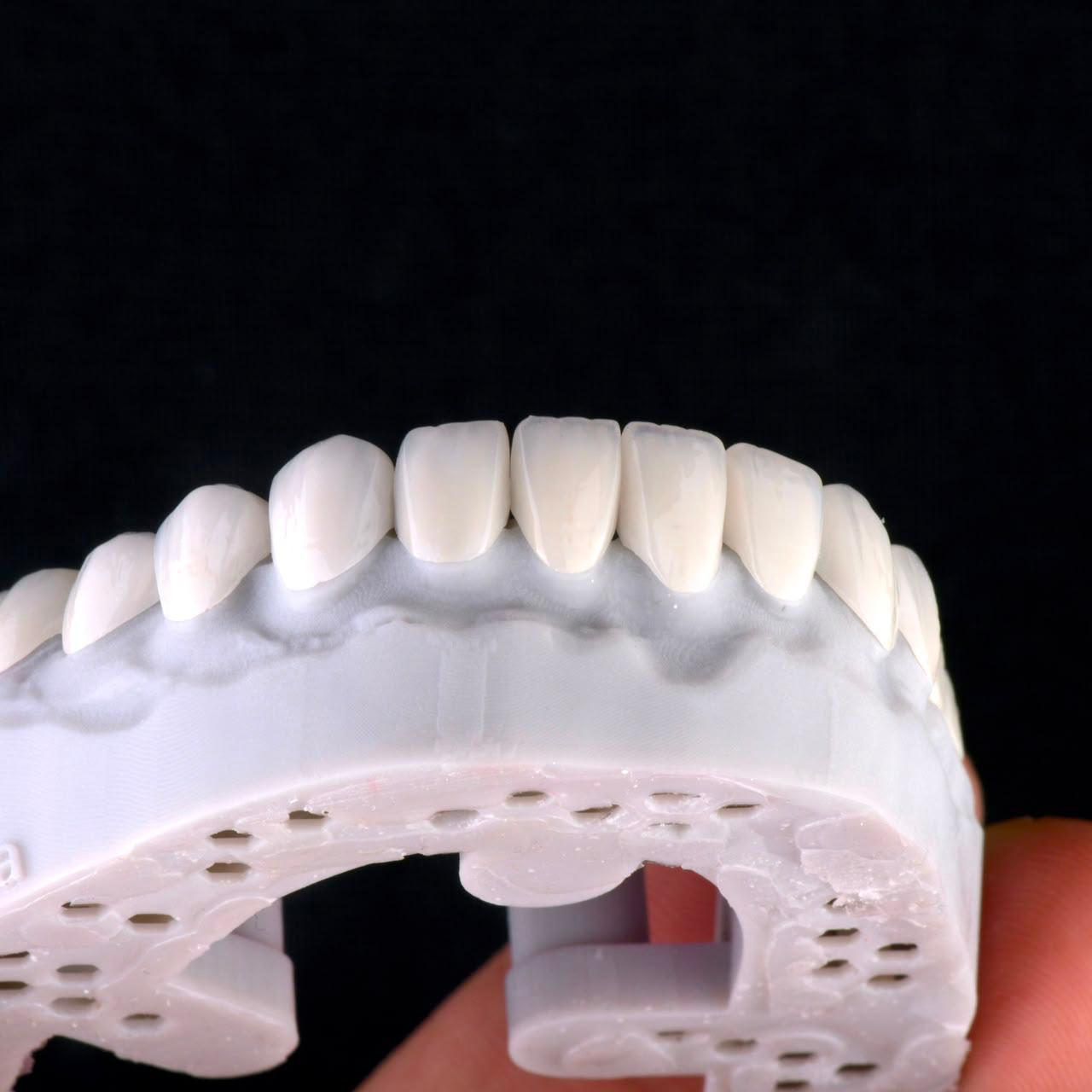 Dental ceramic case at Sari's Clinic