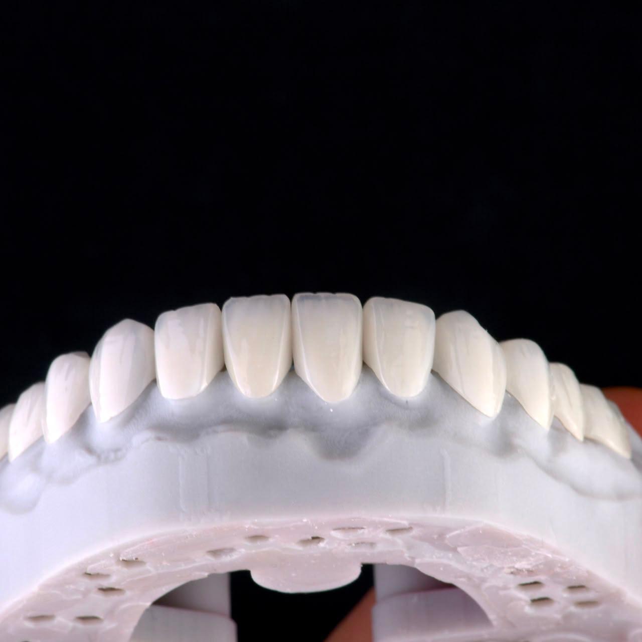Dental ceramic case at Sari's Clinic