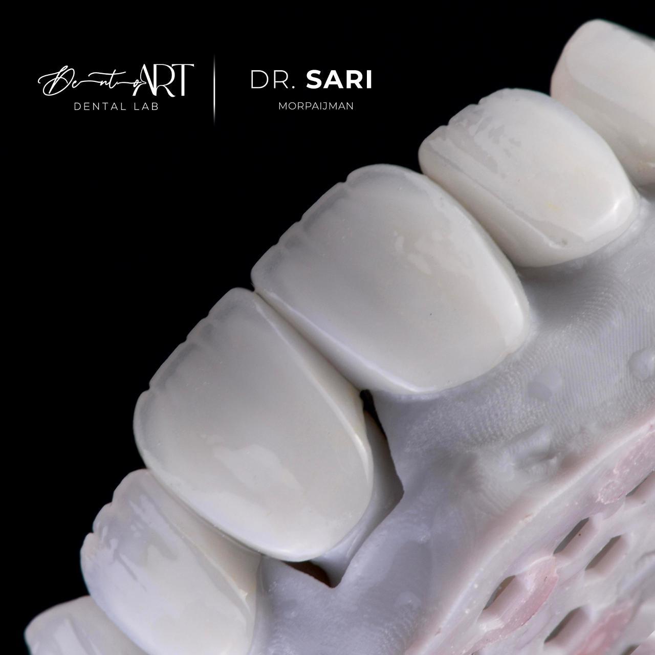 Macro ceramic finish at Sari's Clinic