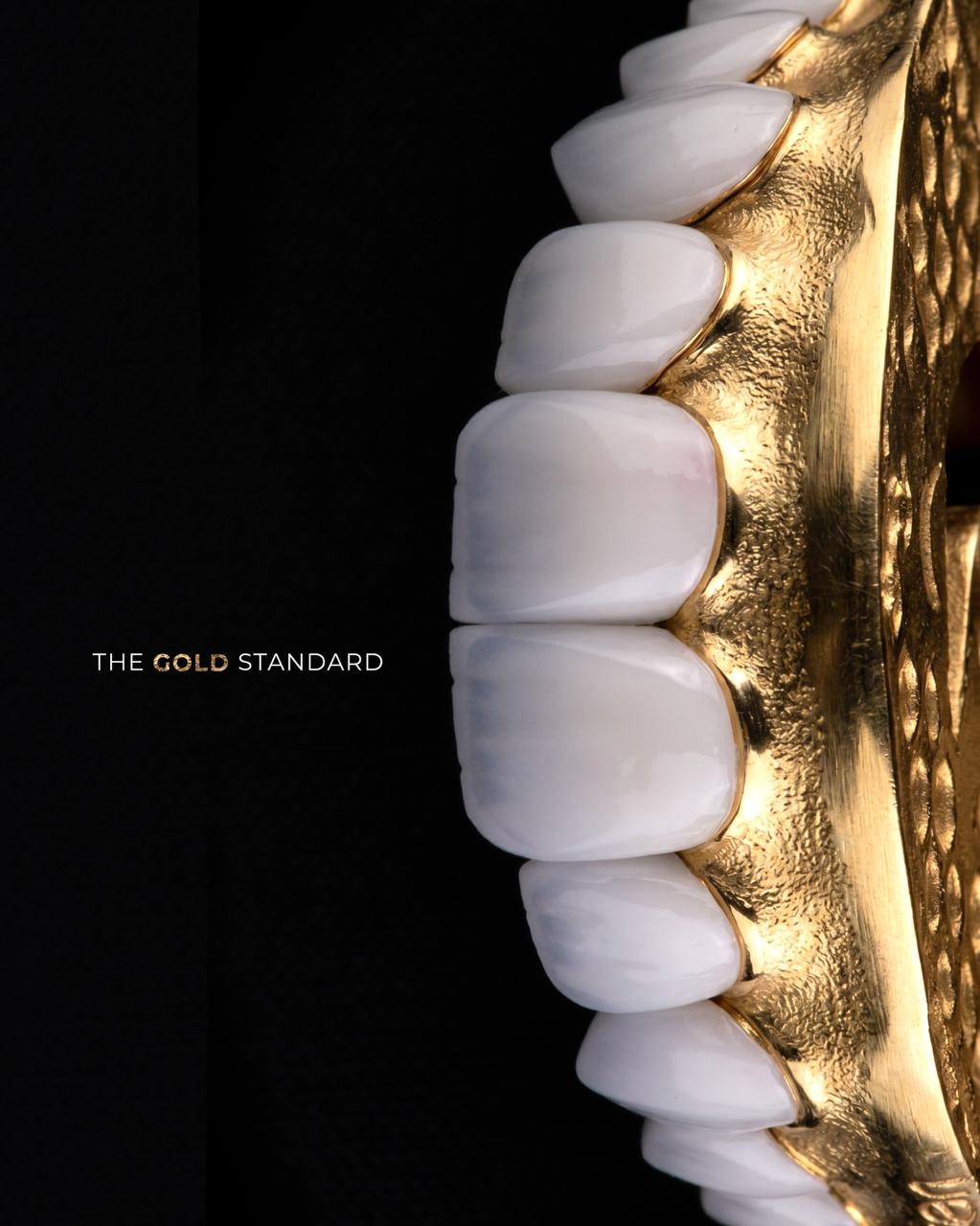 The gold standard veneer work at Sari's Clinic