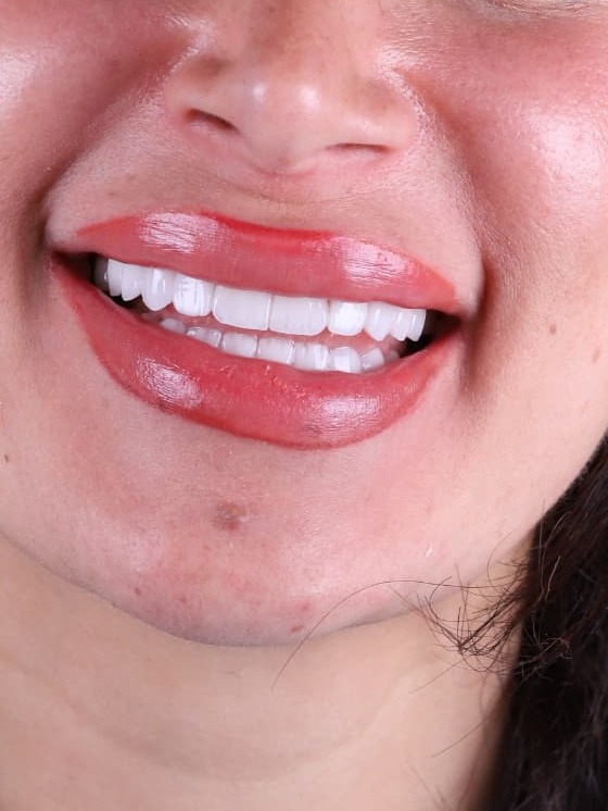 Natural finish case at Sari's Clinic